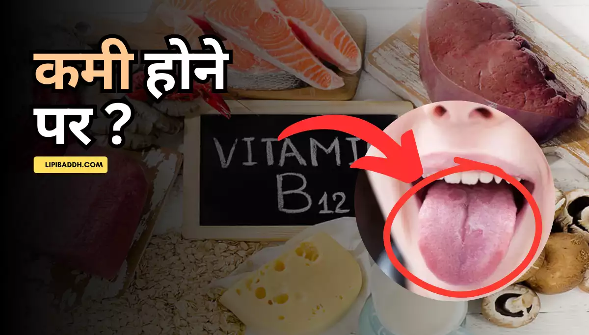 Vitamin B12 Ki Kami Ke Lakshan