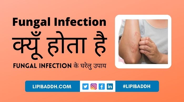 Fungal Infection Kyu Hota Hai - Fungal Infection Ghaarelu Upay