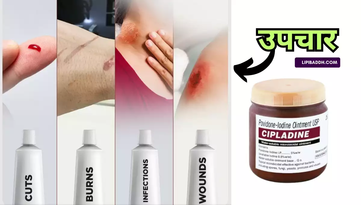 Cipladine Cream Uses in Hindi